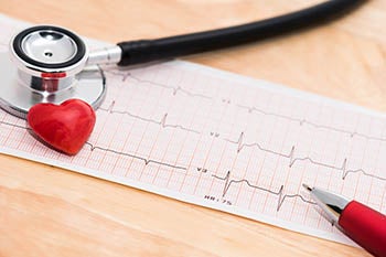 Electrophysiology test