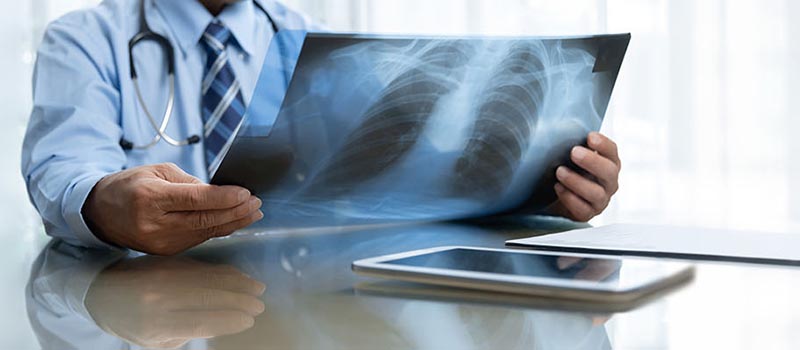 doctor with xray