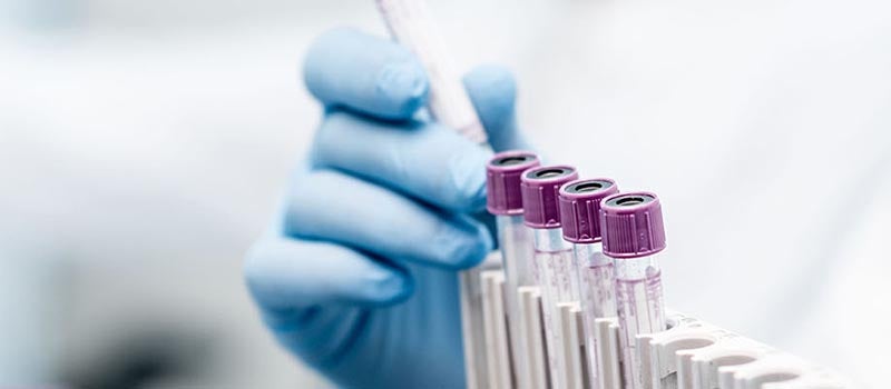 lab tech with vials