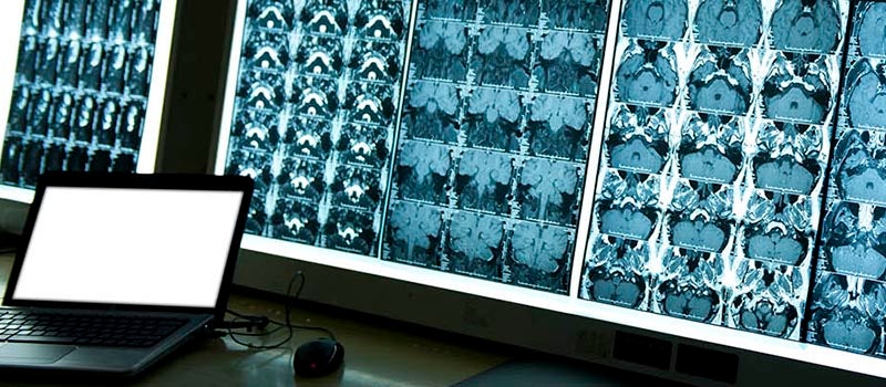 Imaging scans