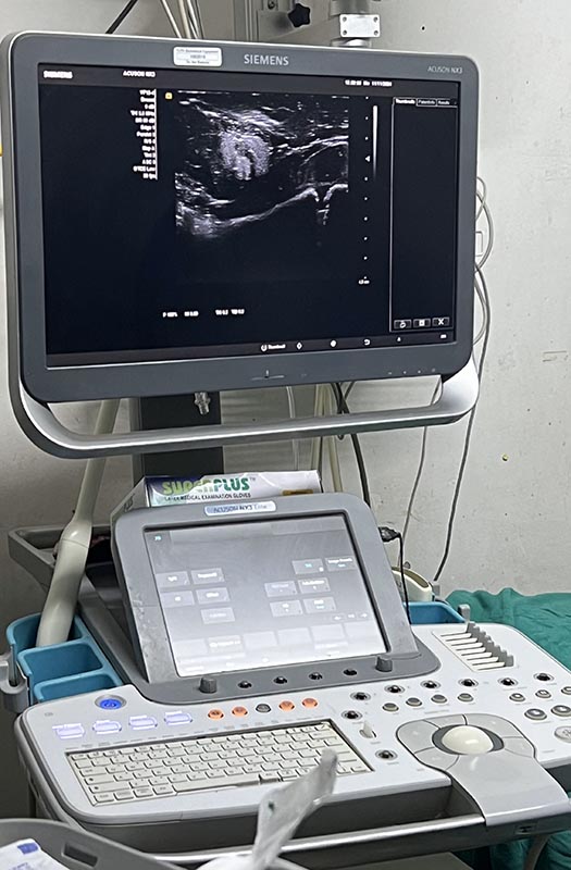 ultrasound