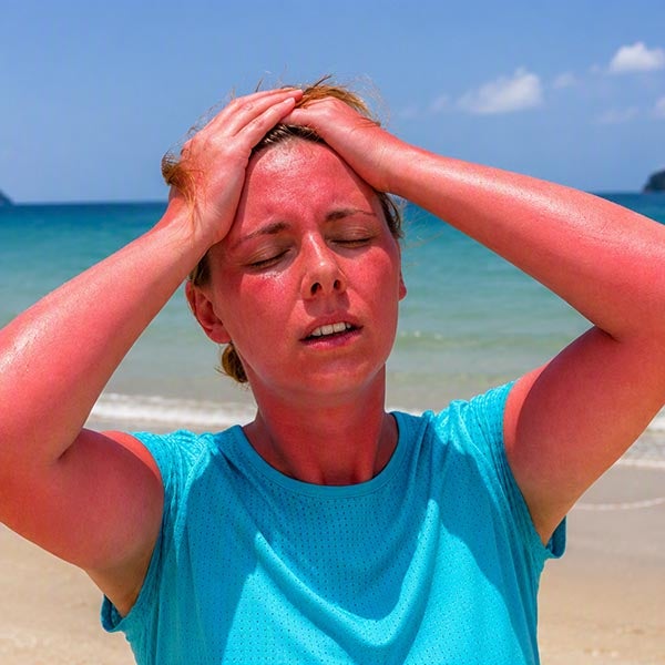 sun poisoning