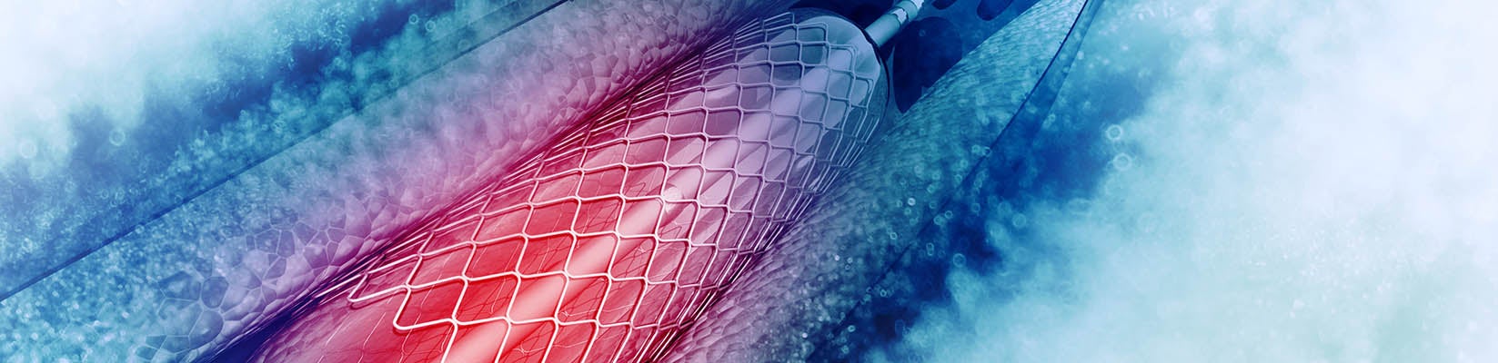 cardiac stent